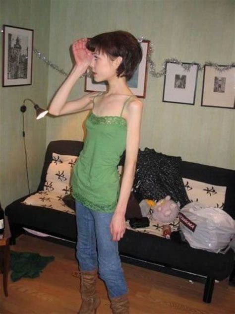 Results for : <b>anorexic</b> pussy. . Shaved anorexic girls